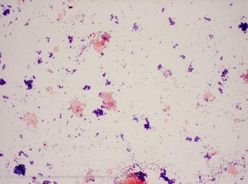 Why Are Gram Positive Bacteria Stained Purple After The Gram Staining Procedure